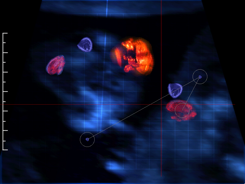 Fig6A_Gestation01.jpg